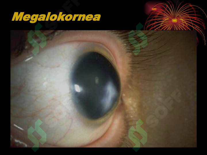 Preview 5