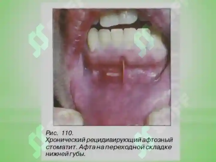 Preview 8