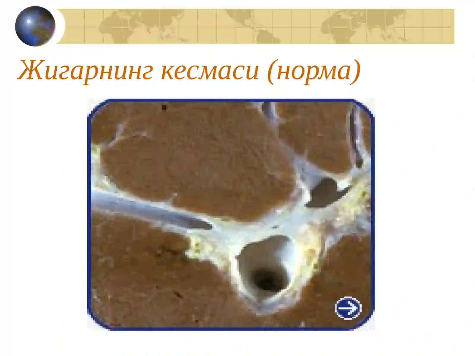 Preview 4