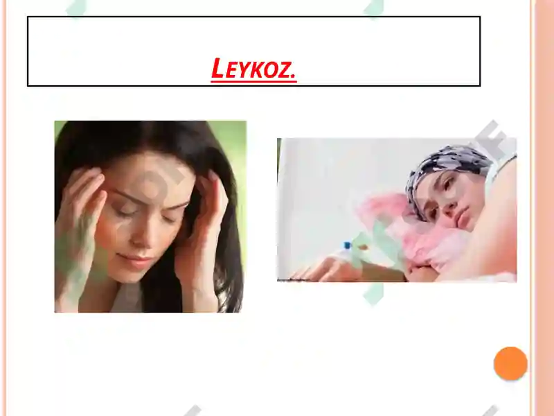 Preview 8